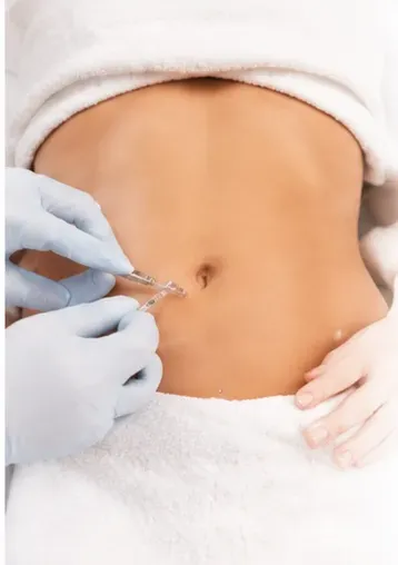 Carboxiterapia